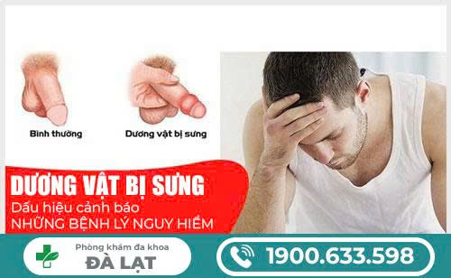 Hình ảnh minh họa